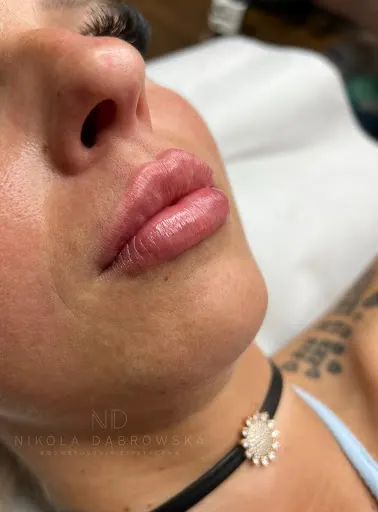 Medycyna Estetyczna i Kosmetologia Nikola Dąbrowska